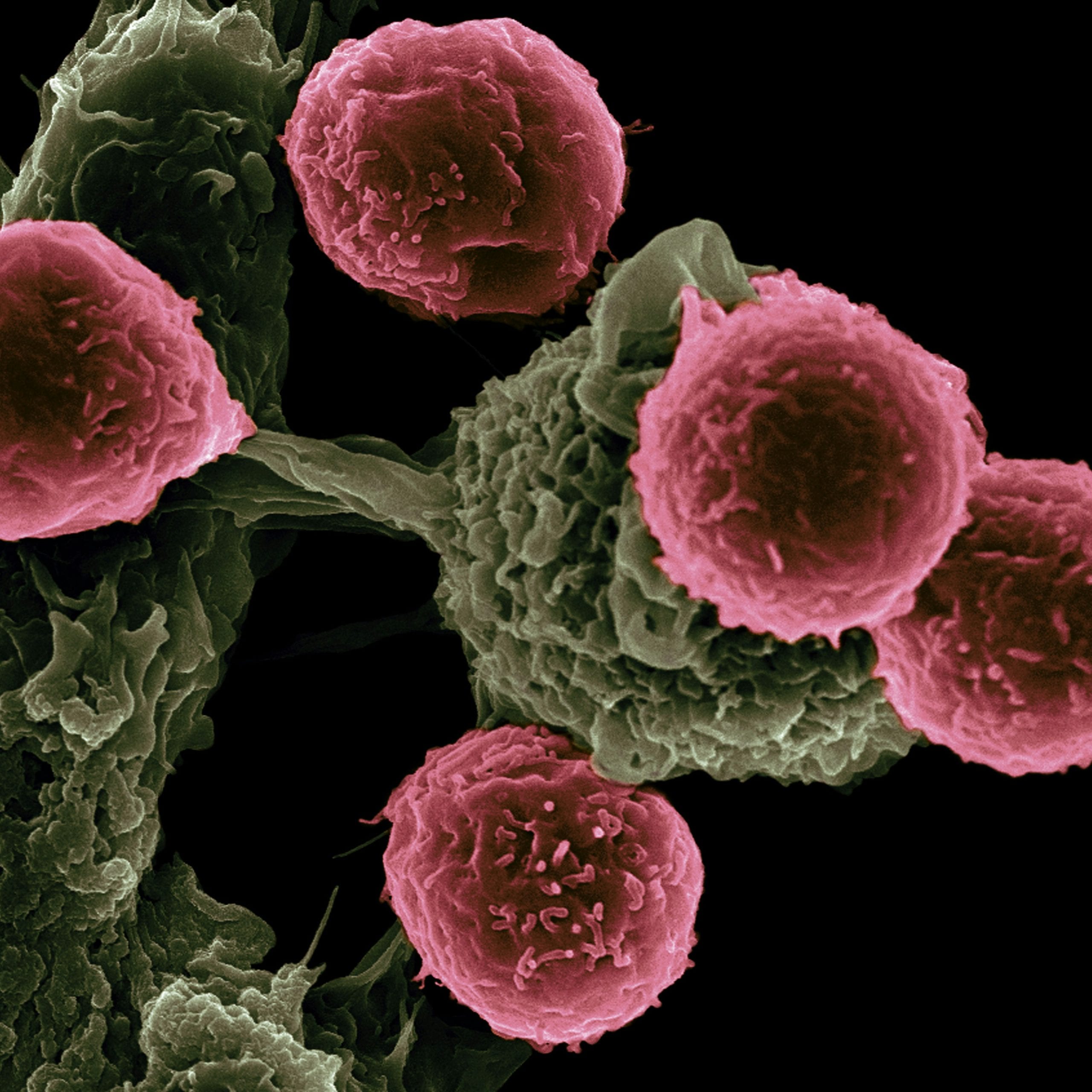 Clasificación general del cáncer