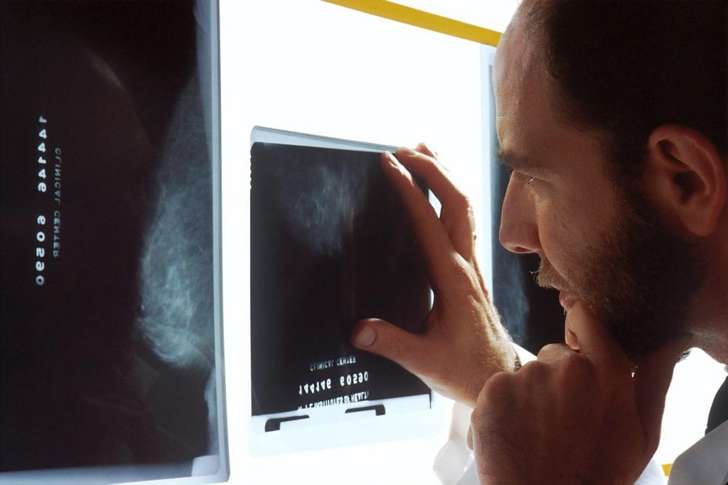 ¿Qué es el cáncer? Definición, causas y cómo se desarrolla en el cuerpo